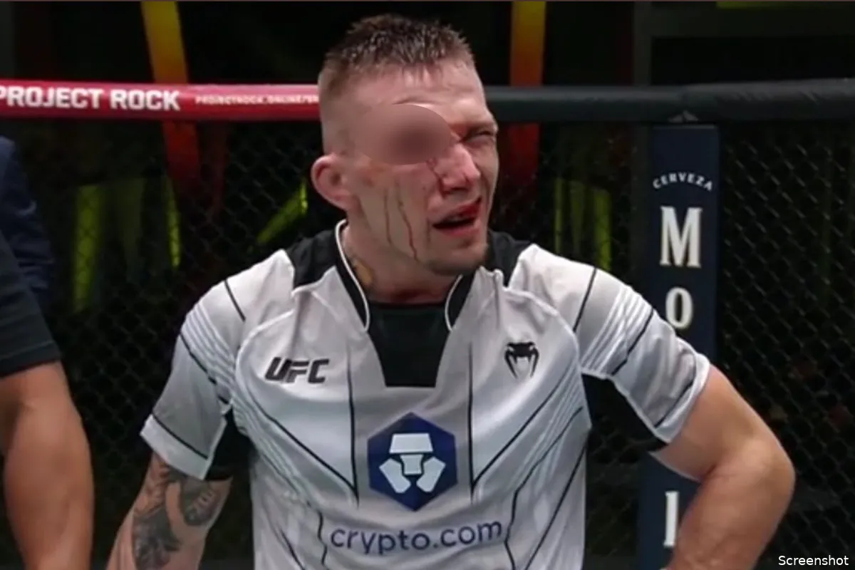 Slachting! UFC gevecht gestopt vanwege heftige blessure kooivechter