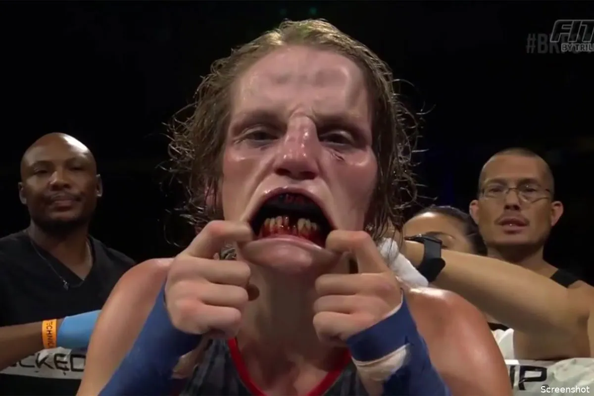 🎥 Bareknuckle Boksster veranderd in The Exorcist na genadeloze afstraffing in de ring