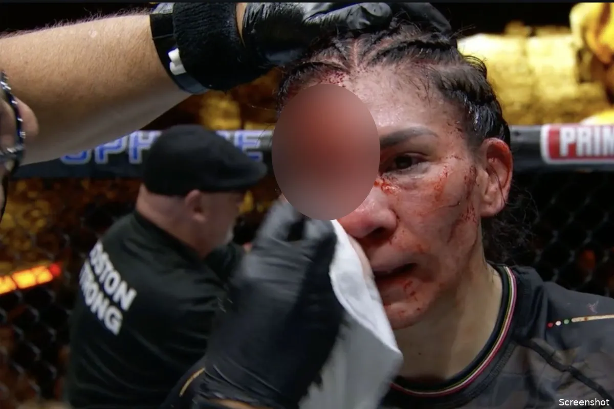 UFC vechter zwaar gewond: Gevecht eindigt in bloedbad