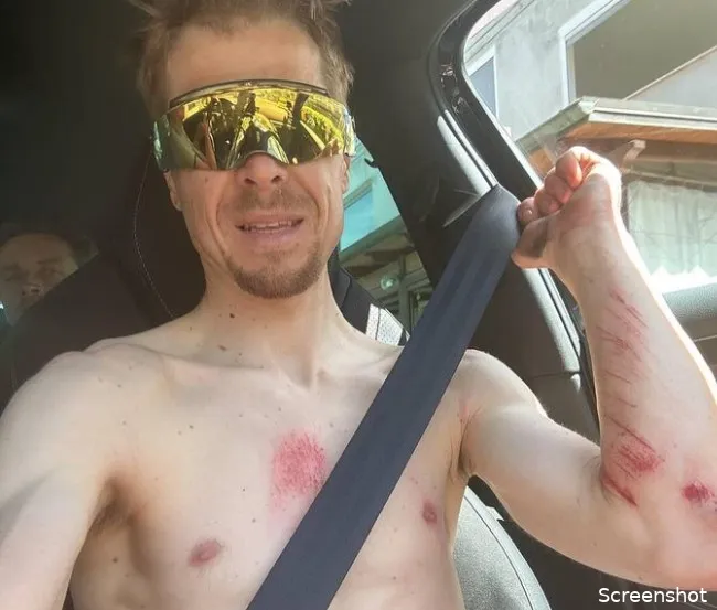 Ontstelde Tratnik (Jumbo-Visma) laat van zich horen: 'Auto-ongelukken kunnen wreed zijn'