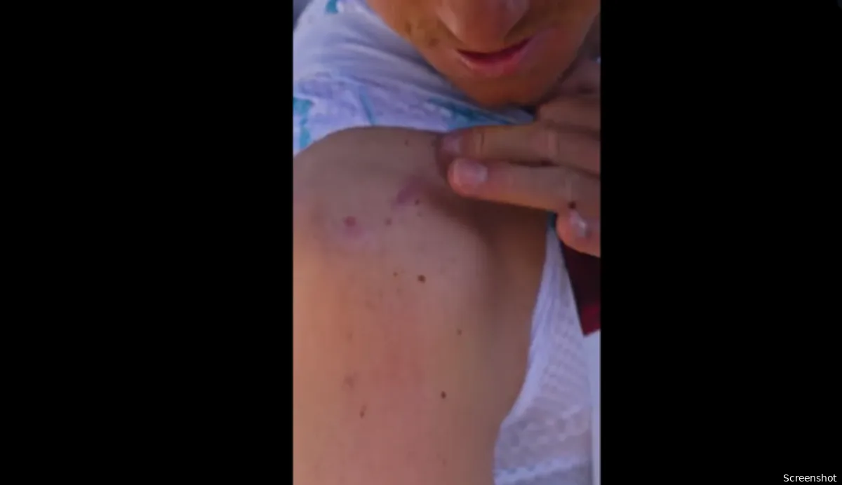 litteken evenepoel