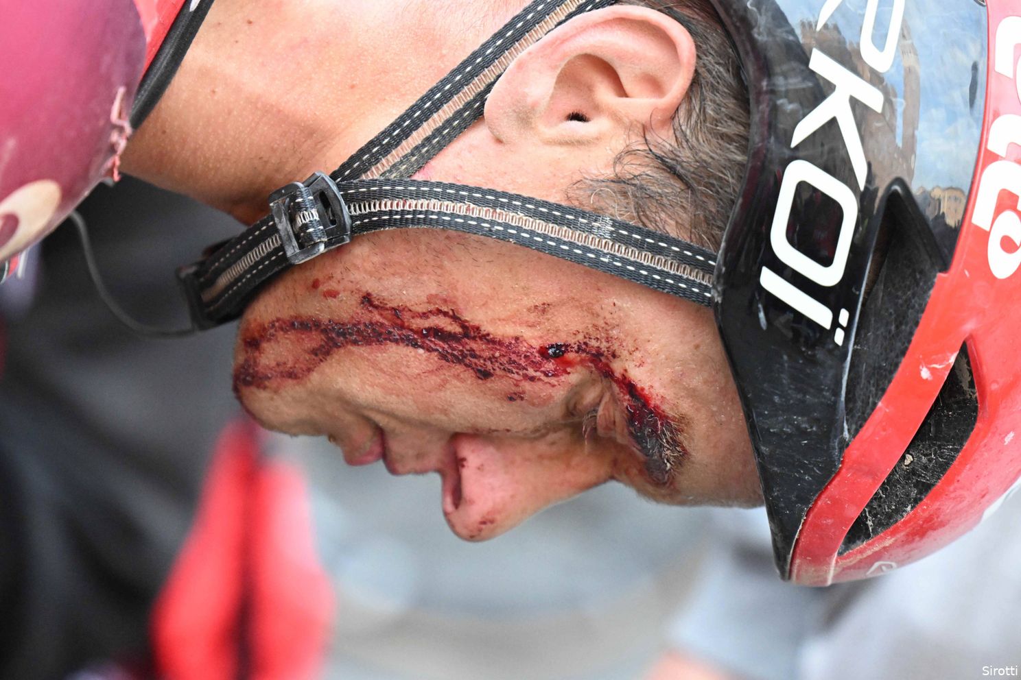 Breuken, hechtingen en kneuzingen: overvol medisch bulletin na vele valpartijen in Strade Bianche