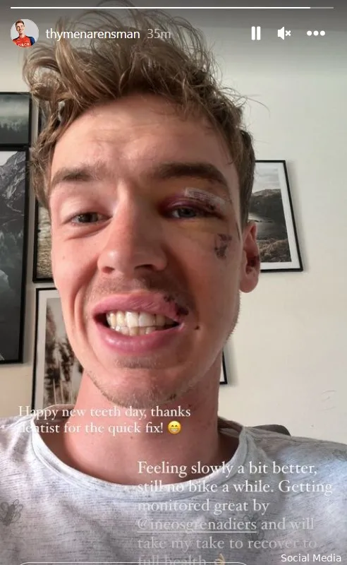 📸 'Tandarts, bedankt voor de quick fix'; Arensman toont gerepareerd gebit (en zit voorlopig niet op de fiets)