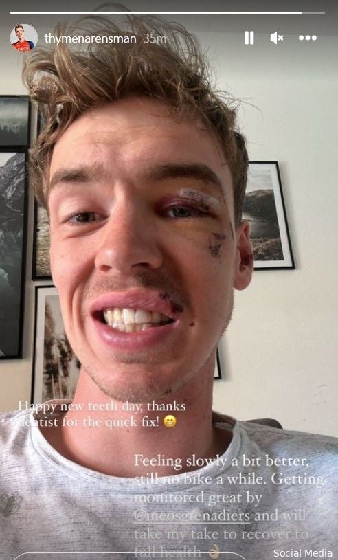 📸 'Tandarts, bedankt voor de quick fix'; Arensman toont gerepareerd gebit (en zit voorlopig niet op de fiets)
