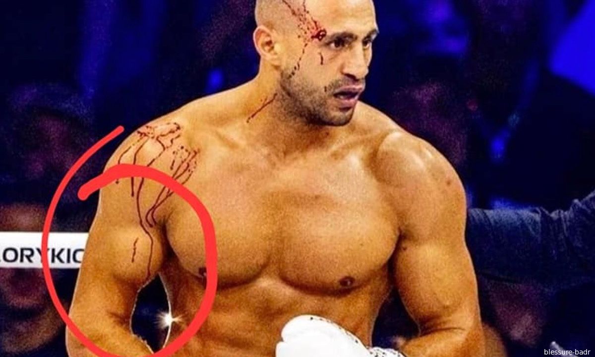 Badr Hari zwaar geblesseerd?