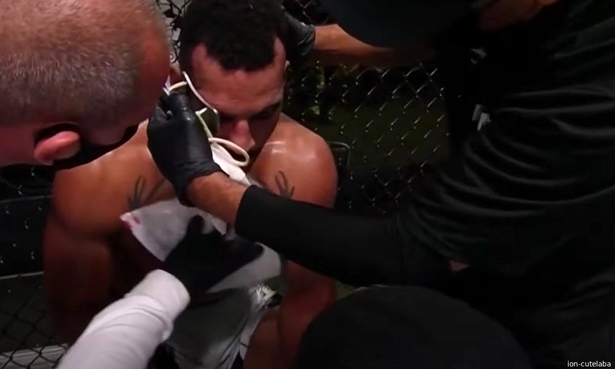 UFC-vechter krijgt knietje op kaak, gebit volledig aan diggelen