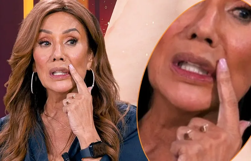 Botox gaat helemaal fout: Patty Brard loopt rond met scheve mond