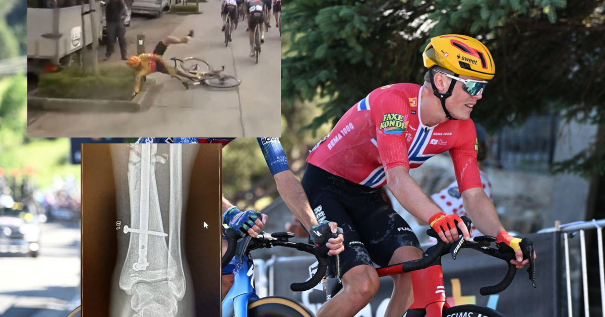 Uno X Rider Finishes Tour De France After 2 Years Without Walking Skaarseth E3 