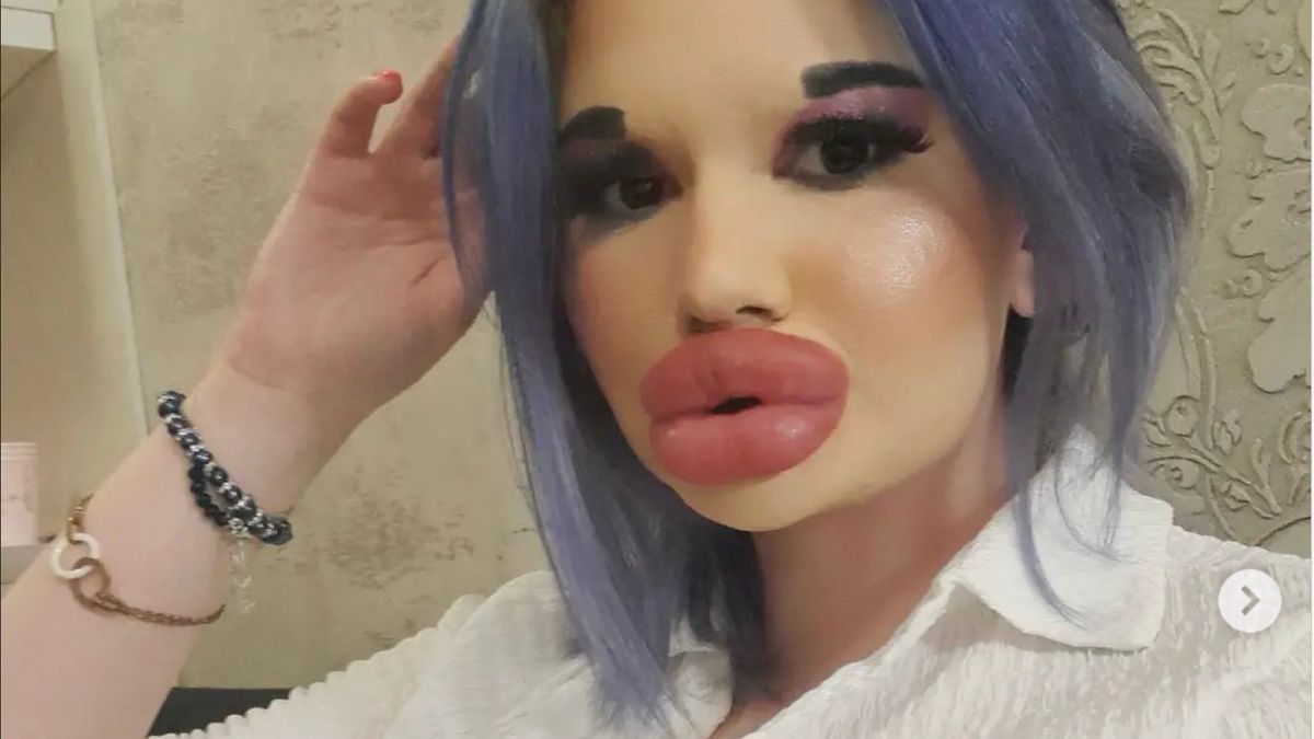 Dit is Andrea, de 'Balkan barbie' die voor 90% uit plastiek bestaat: "Ik  ben knapper met mijn grote lippen" (foto's) | Clint.be