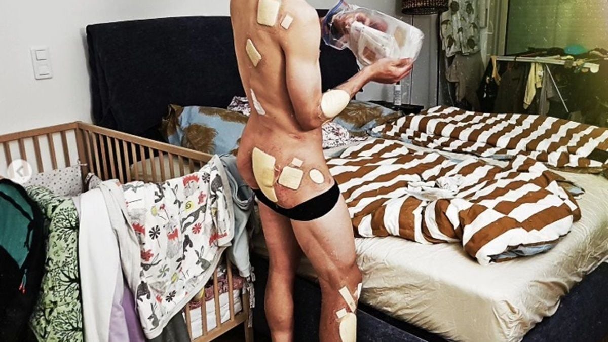 Primoz Roglic shows off extensive injuries in at-home picture |  CyclingUpToDate.com