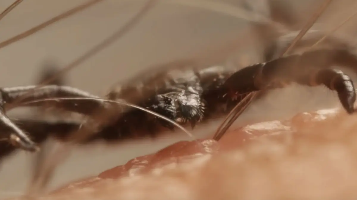 Hoe een bloeddorstige teek te werk gaat in close-up