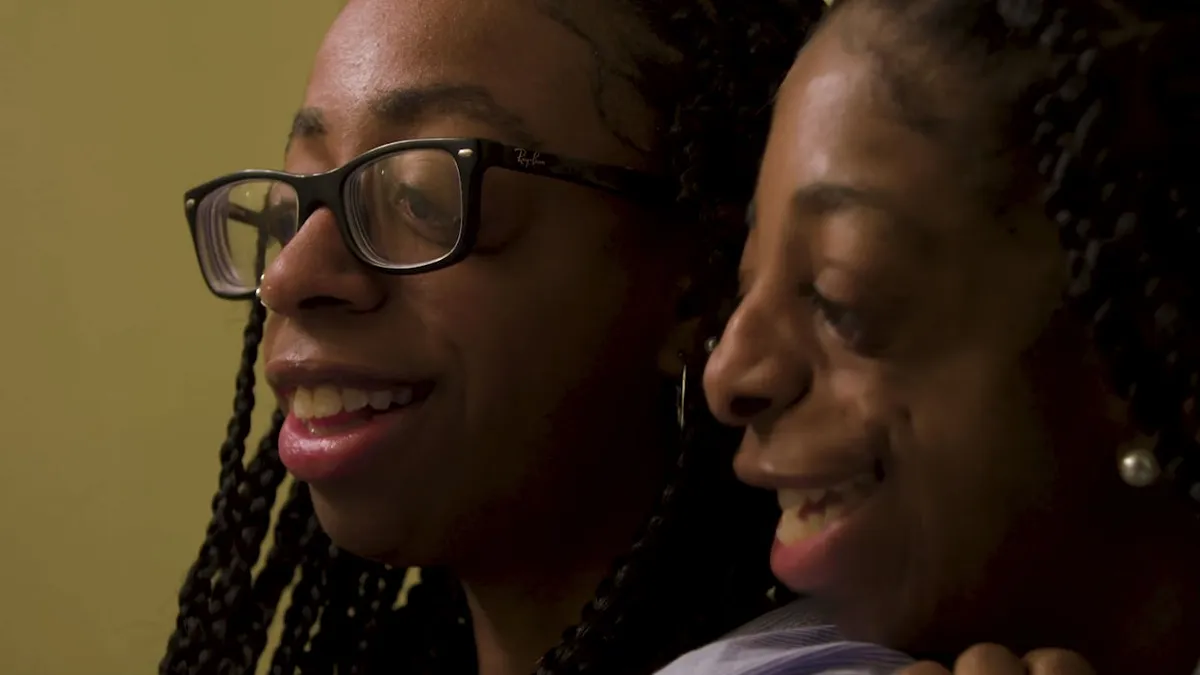 Asia en India hebben Treacher Collins syndroom