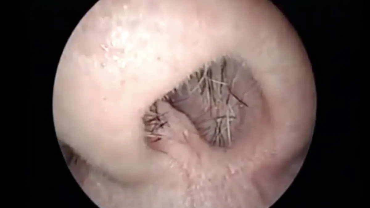 Dokter op bloedzuiger jacht in man zijn gok