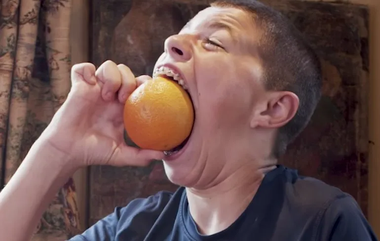 Goedemiddag, zou ik met Summon kunnen spreken?