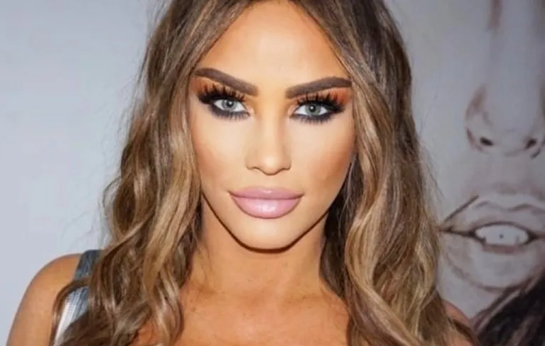 Katie Price heeft zichzelf behoorlijk laten toetakelen in Turkije