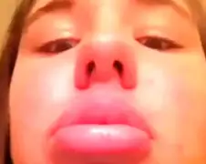 Kylie Jenner Lip Challenge fail compilatie