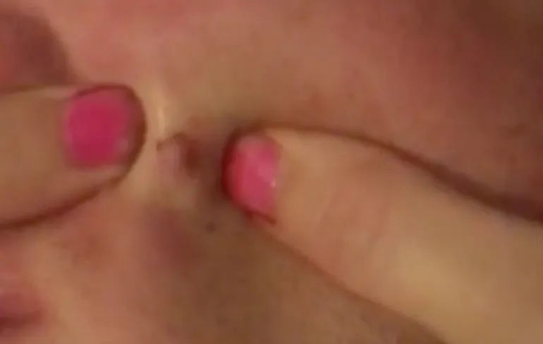 Prachtig pop momentje voor 4 jaar oude pukkel