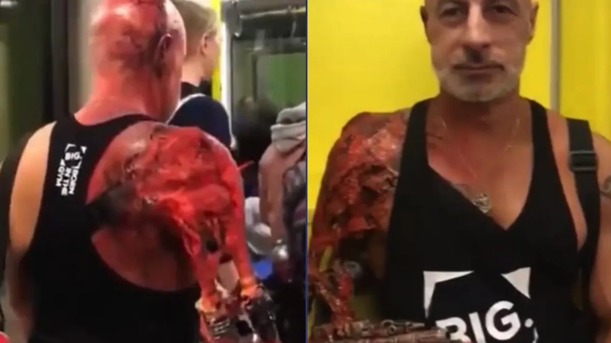 Bionische mens is ook gewoon een mens