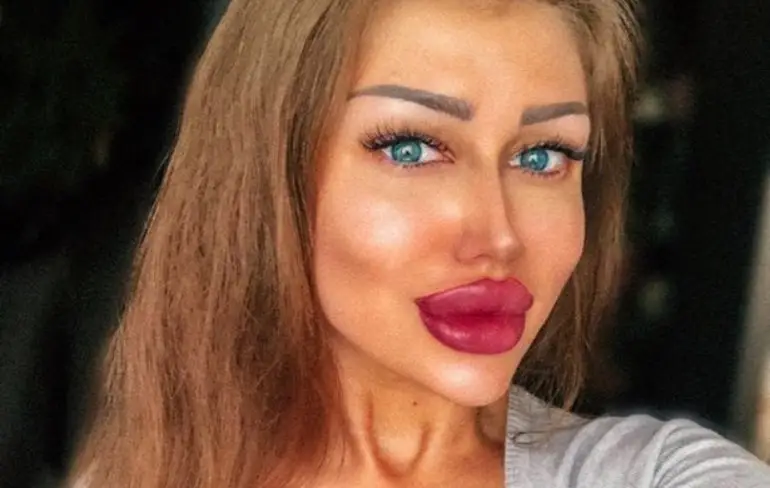 Insta model Ekaterina Galichenko zegt nooit iets te hebben laten verbouwen