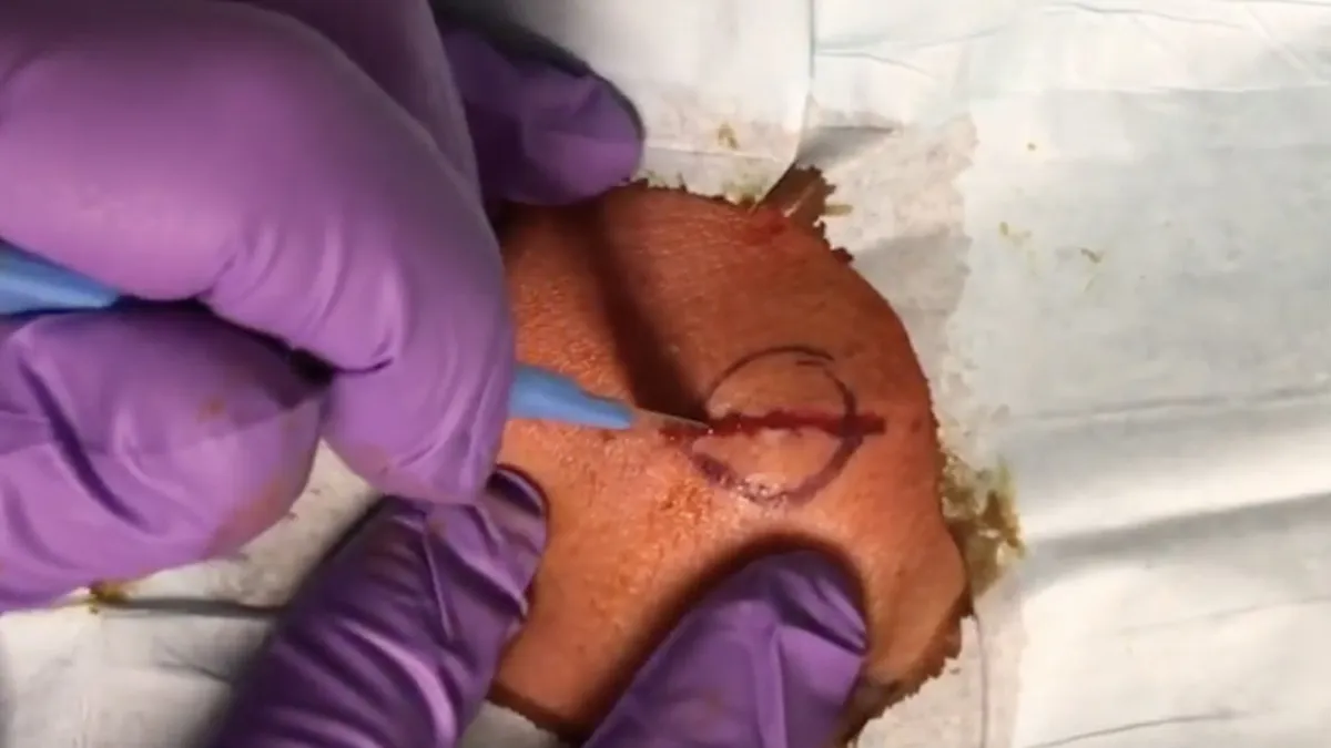 Keurig nette cyste uitpakken