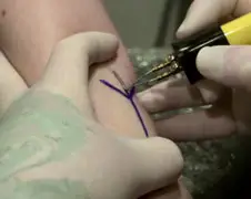 Desire meet een paar brandwonden aan