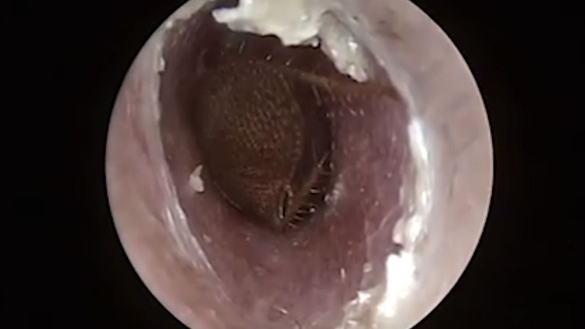 Kakkerlak is in oor gekropen en moet er nu weer uit