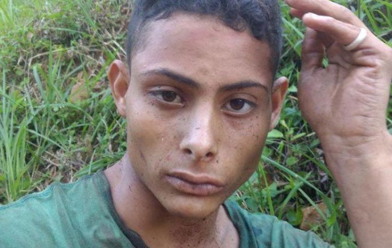 WTF: Poging tot onthoofding van slachtoffer overval in Brazilië