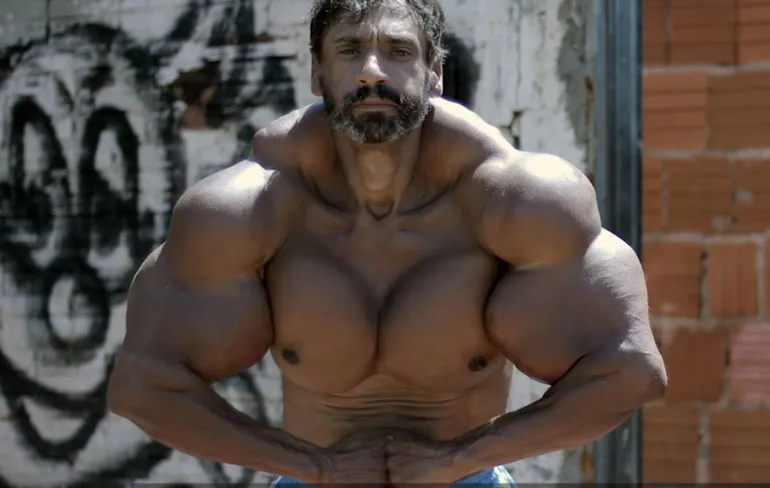 Braziliaanse Valdir gebruikt een beetje te veel Synthol