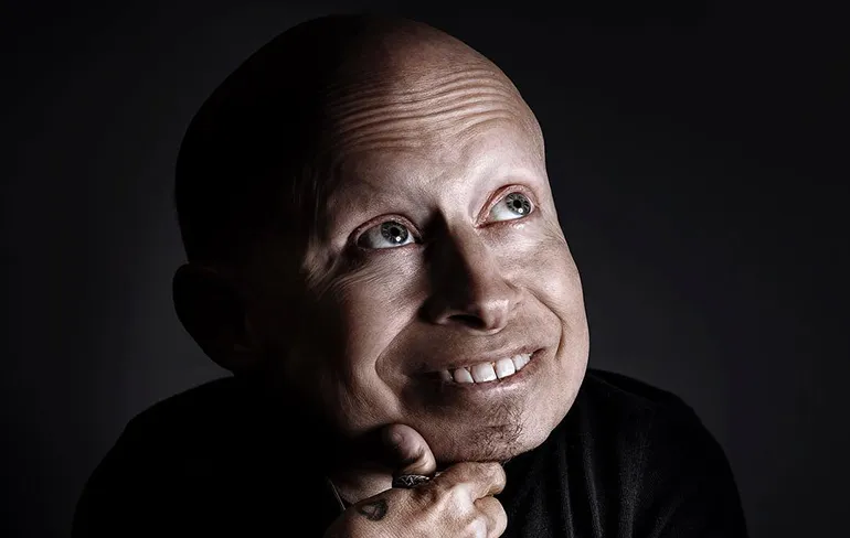 Austin Powers-acteur Verne Troyer aka Mini Me overleden