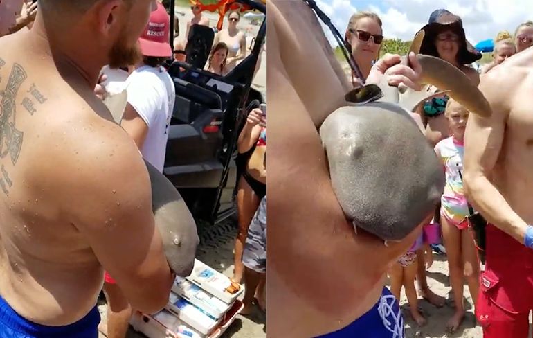 Baby Verpleegsterhaai bijt zich vast in arm strandganger Florida