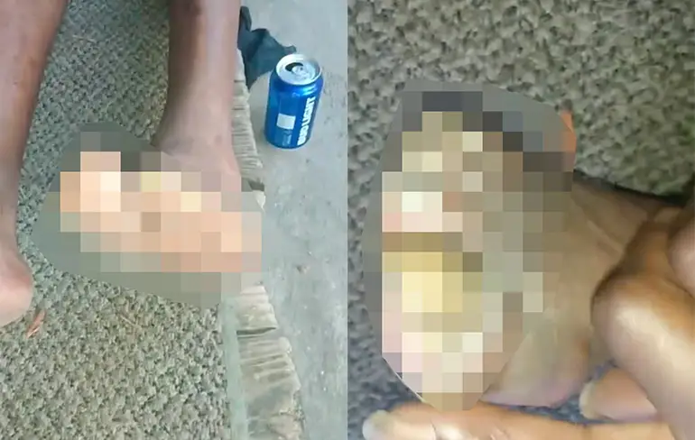 Bruh, jij moet op zeker eens langs bij Miss Foot Fixer