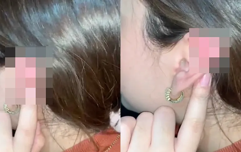 De bedoeling was een piercing, maar kan nu zo meedoen met Star Trek