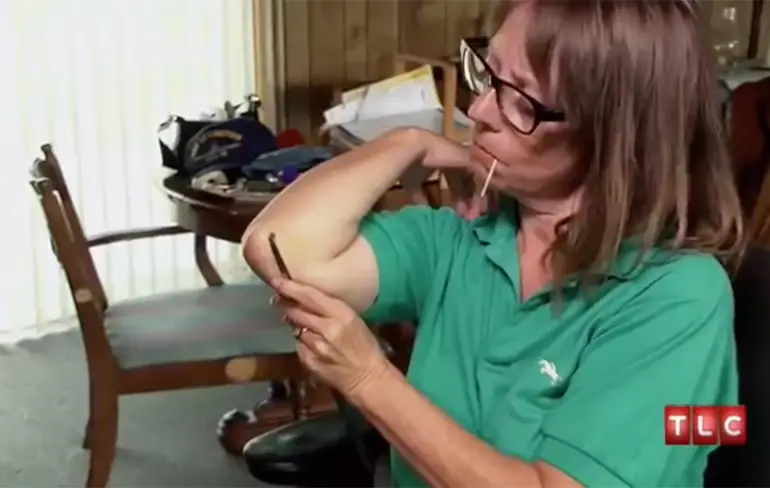 De ergste gevallen uit TLC programma My Strange Addiction