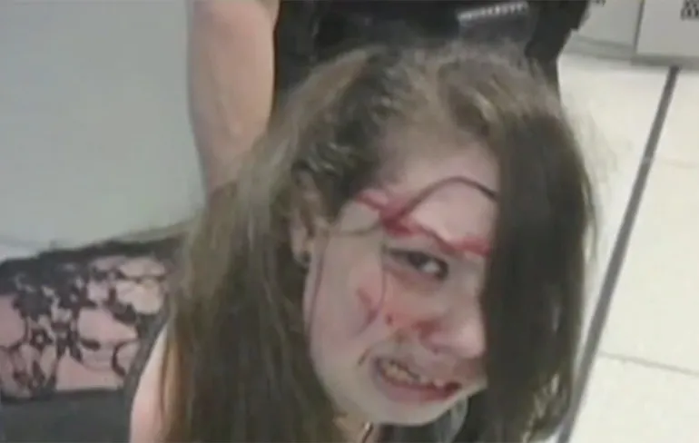 Deels doof, blind en verlamd meisje met kanker hard aangepakt door TSA