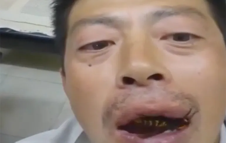 Doe eens gek, stop een Japanse reuzenhoornaar in je mond!