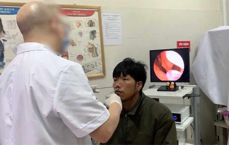 Dokter in Vietnam haalt glibberige parasiet uit neus van man