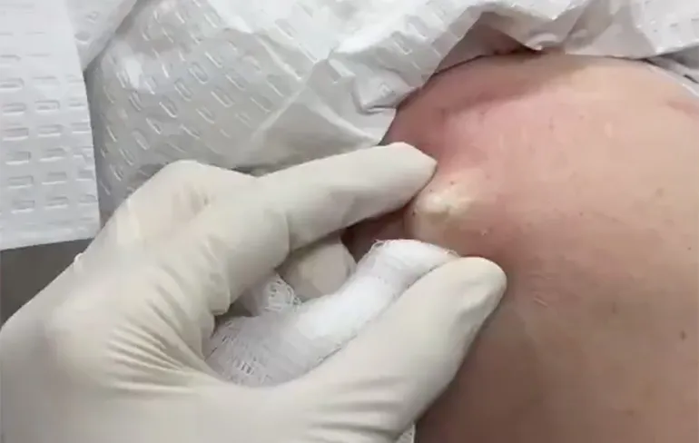 Dr. Pimple Popper laat zien waar ze haar mayonaise vandaan haalt!