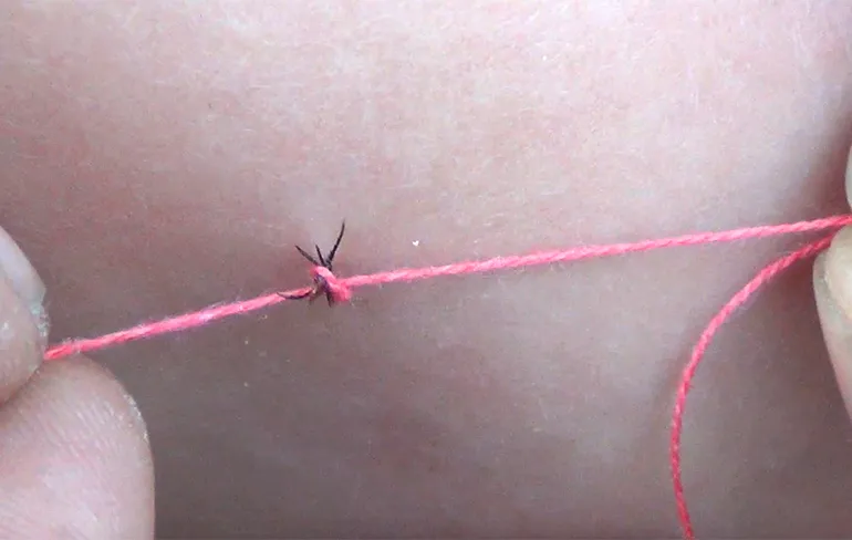 Een teek verwijderen kan ook met een draadje...