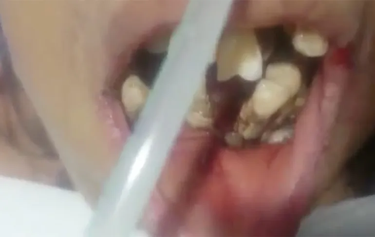 Eh mevrouw, heeft u de laatste 20 jaar wel uw tanden gepoetst?