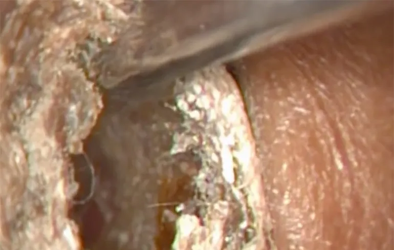 En nu? Kun je ons nu weer glashelder horen?