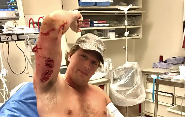 Freek Vonk bijna dood na aanval rifhaai, echt bijna!