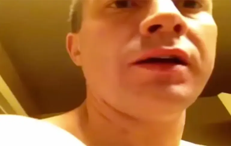 Gast zijn hele arm lijkt wel een puist vol rotzooi!