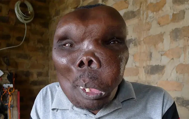 Godfrey Baguma is de vreemdst uitziende man van heel Oeganda