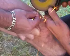 Hardcore manier om vishaakje uit been te verwijderen