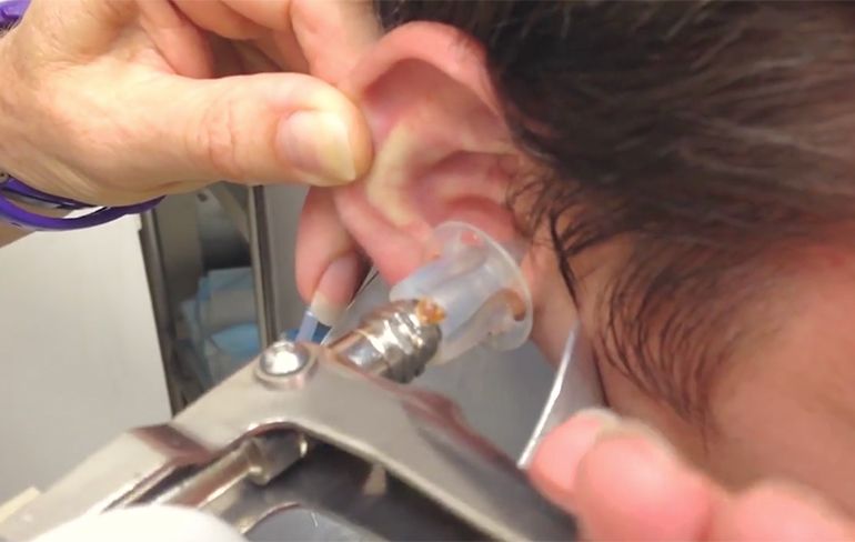 Hoe vaak maak jij je oren schoon?