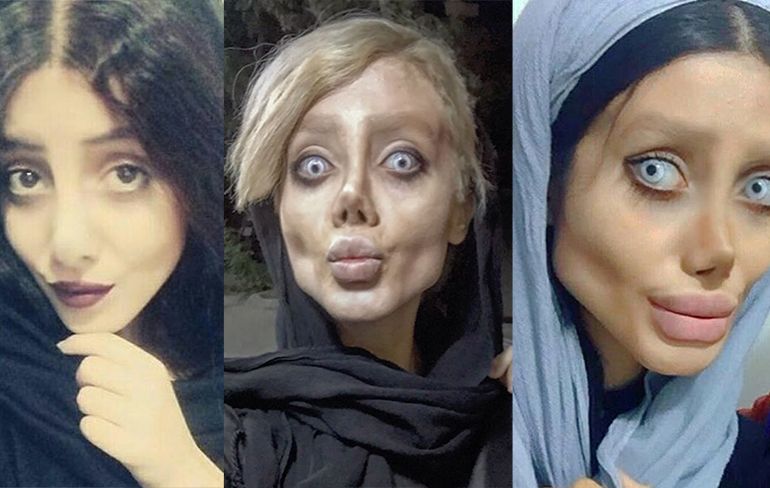 Knettergek: Vrouw ondergaat 50 operaties om op Angelina Jolie te lijken