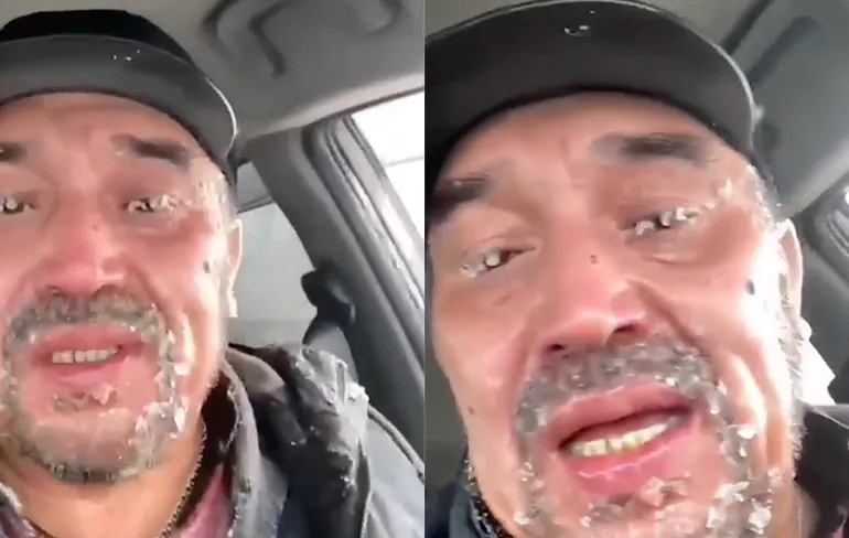 Man in Kazachstan heeft echt bevroren oren nadat hij pech kreeg met zijn auto