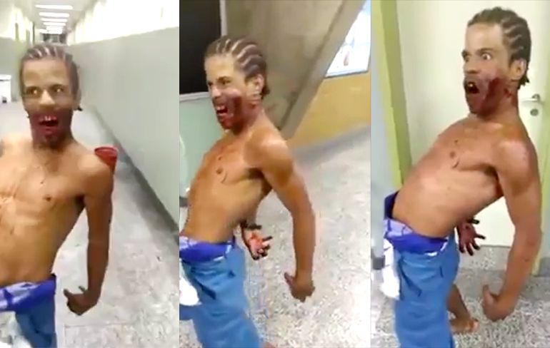 Man met schotwond gedraagt zich als een zombie in ziekenhuis