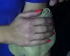 Meisje wordt van puistje op haar arm af geholpen