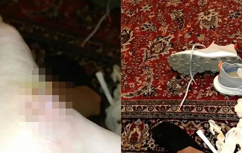 Nee joh, loop jij anders een maand met een splinter in je voet